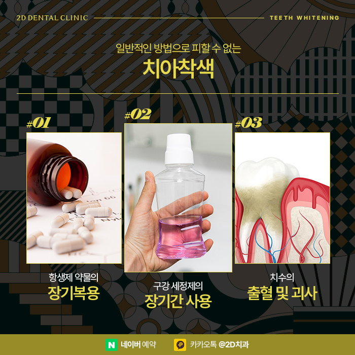치아미백을 통한 첫인상의 변화, 강남 치아 화이트닝 관련 이미지 2