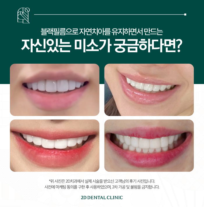 무삭제라미네이트비용 블랙필름 가격, 효과는 어떨까? 관련 이미지 7