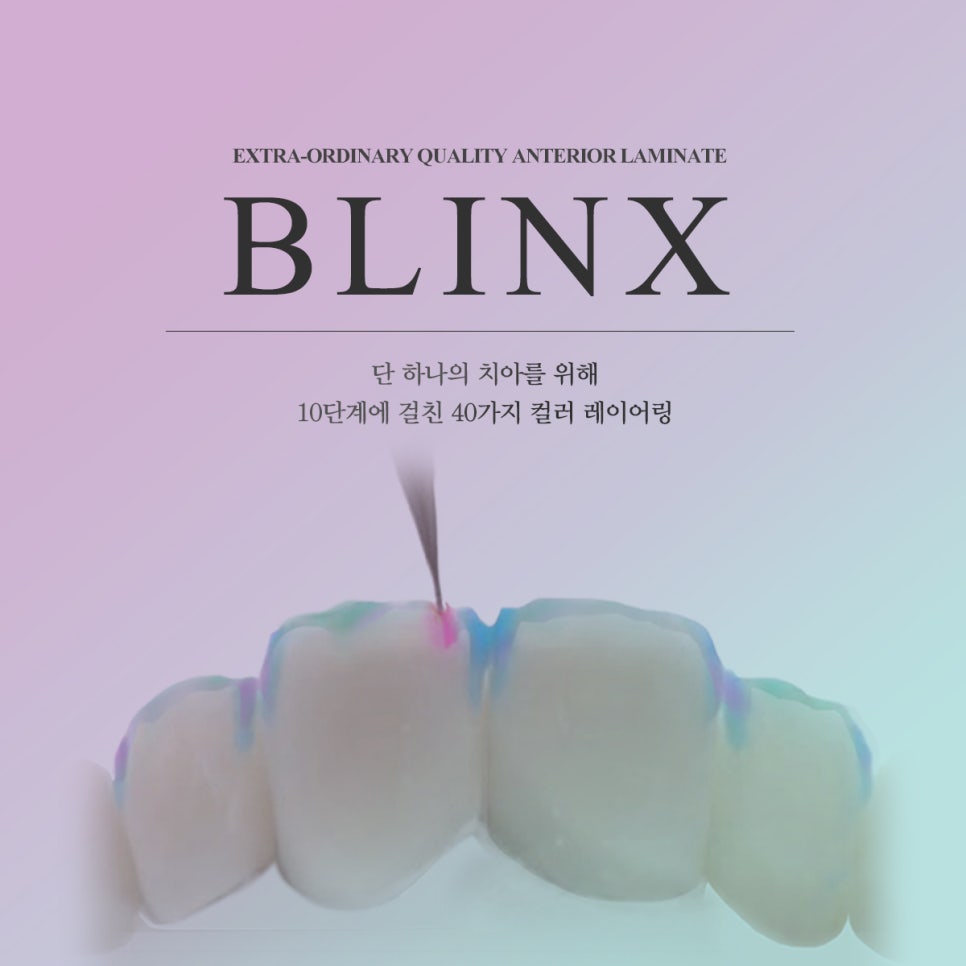 "100시간의 법칙, 블링스"란 무엇인가요? 관련 이미지 1