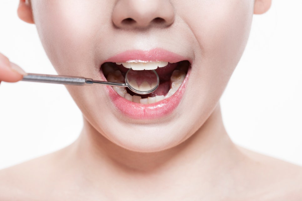 생소했던 치아구조, 함께 알아봐요! 관련 이미지 3