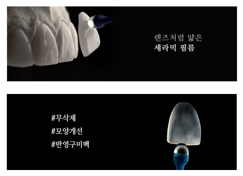앞니깨짐, 치아미백엔 무삭제 "쎄라필름(TheraFilm)" 관련 이미지 4