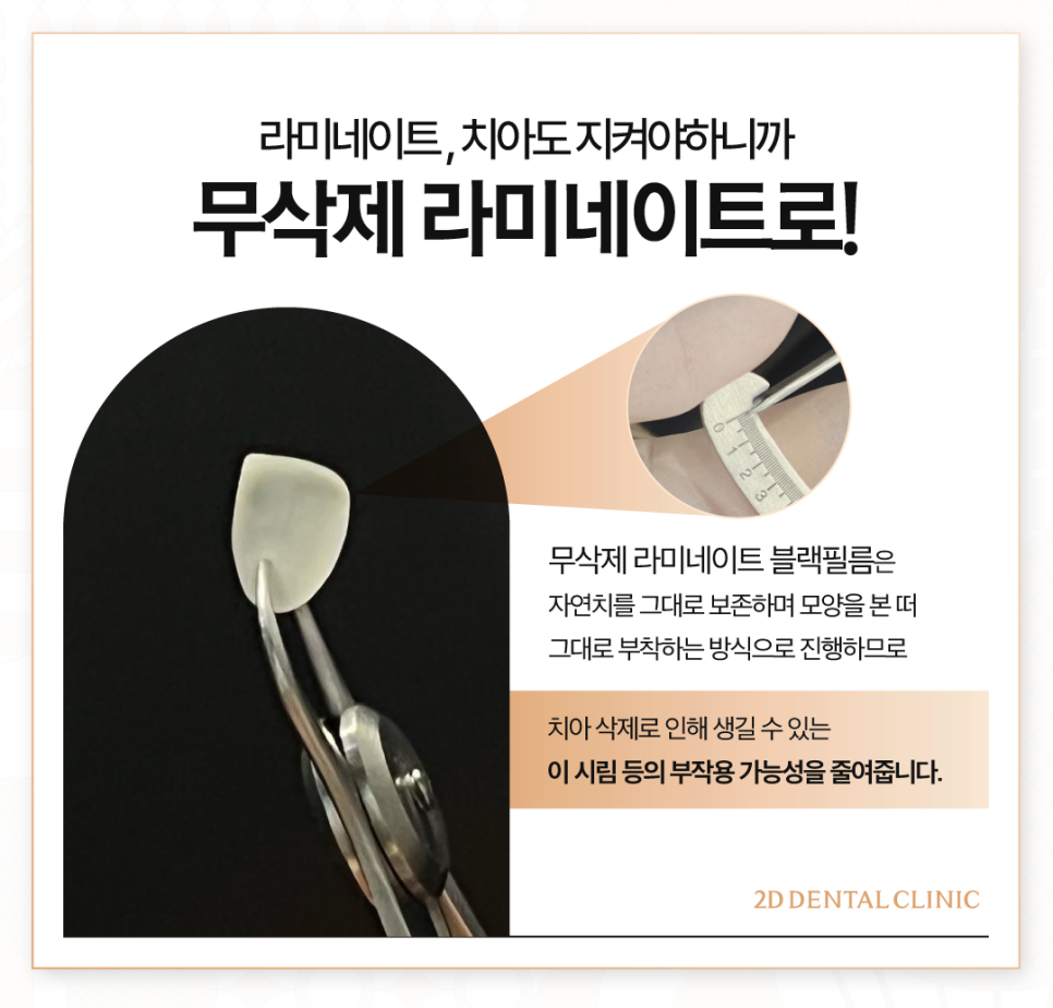 치아무삭제라미네이트 치아성형 연예인처럼 가지런한 앞니 관련 이미지 5