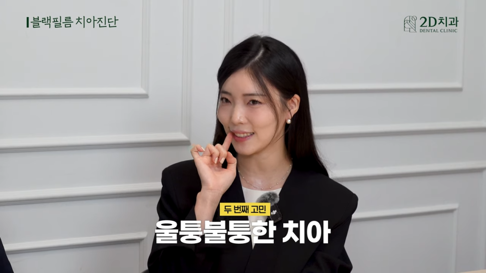 치과상담 앞니라미네이트 교정 치아에도 블랙필름 가능한가요? 관련 이미지 5