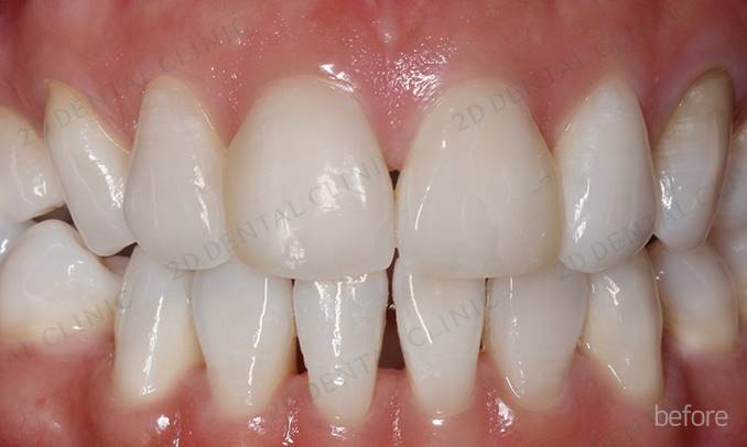 김현진 연애의맛? 또 어디서 봤더라? 관련 이미지 7