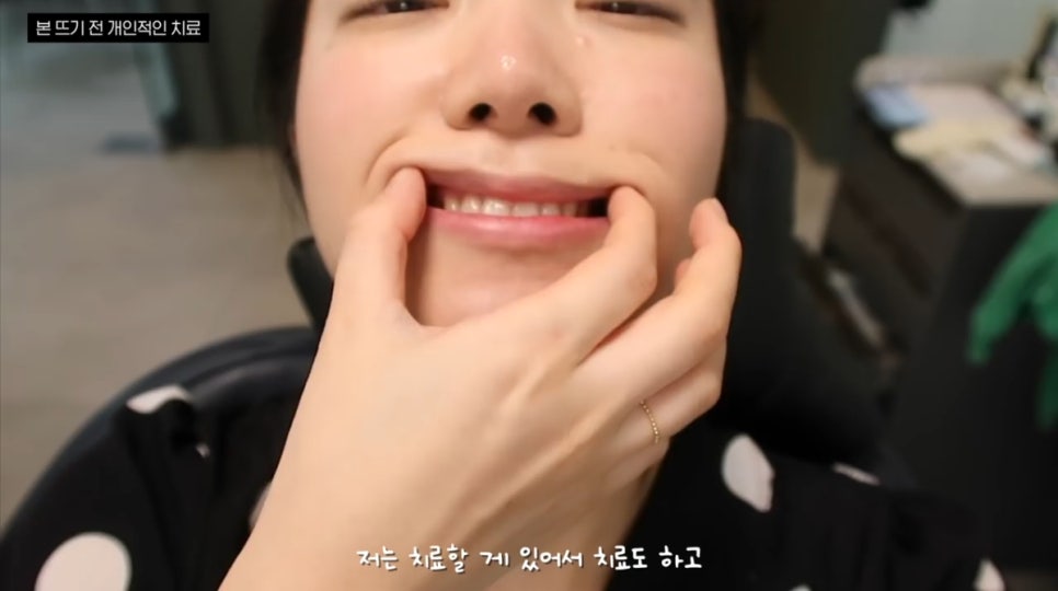 무삭제 라미네이트, 쎄라필름(TheraFilm)후기_유튜버Coco Riley님 by.2D치과(투디치과) 관련 이미지 5