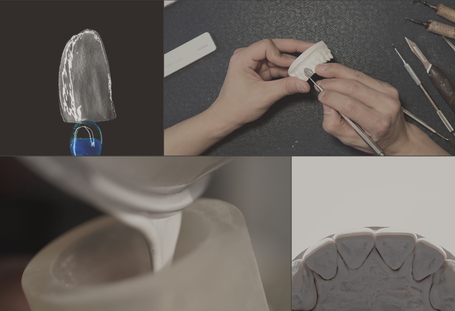 무삭제 라미네이트 비용 알아보기 ! 관련 이미지 1