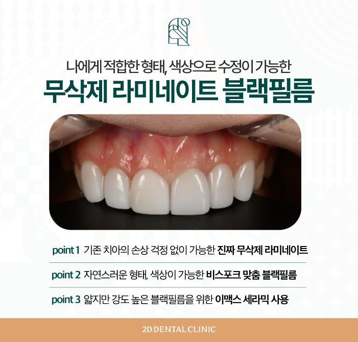 무삭제라미네이트비용 블랙필름 왜소치 고민 해결! 관련 이미지 5