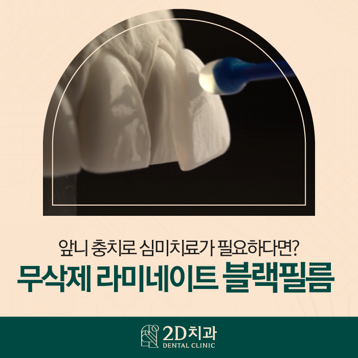 무삭제블랙필름 역삼동치과 앞니 충치 적합한 치료 방법은 관련 이미지 1