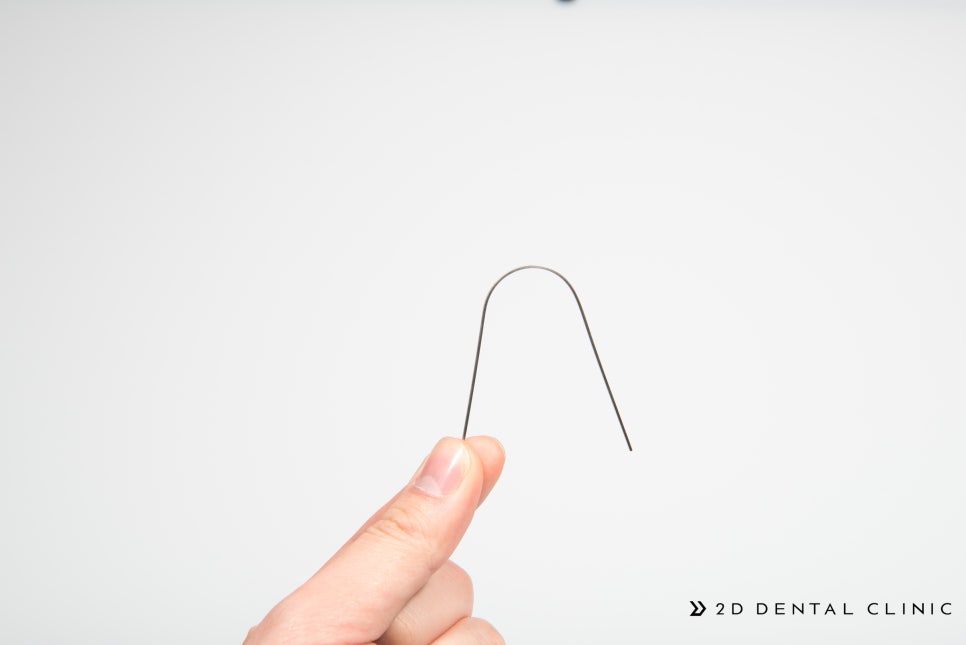[투디(2D)치과] 교정 와이어의 종류 관련 이미지 11