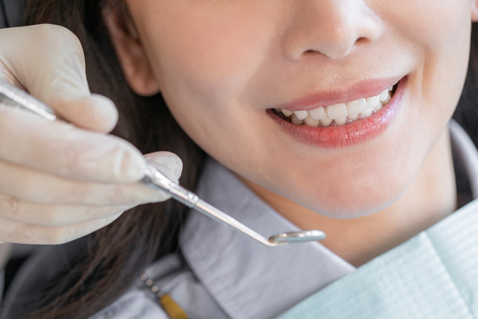 치아 사이 까만 틈, 블랙트라이앵글이란? 관련 이미지 3