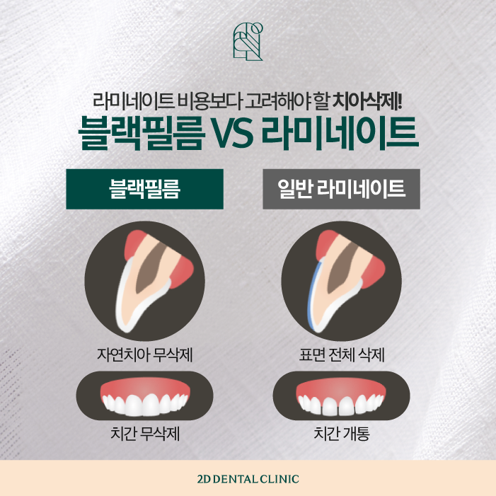 치과라미네이트 비용보다 중요한 것은? 관련 이미지 4
