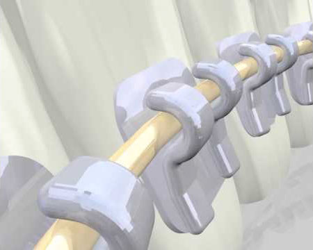 연예인교정 2D교정, 역시 2D치과! 관련 이미지 7