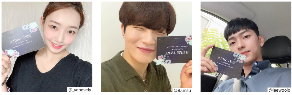 연예인라미네이트 어디가 잘할까? 관련 이미지 8