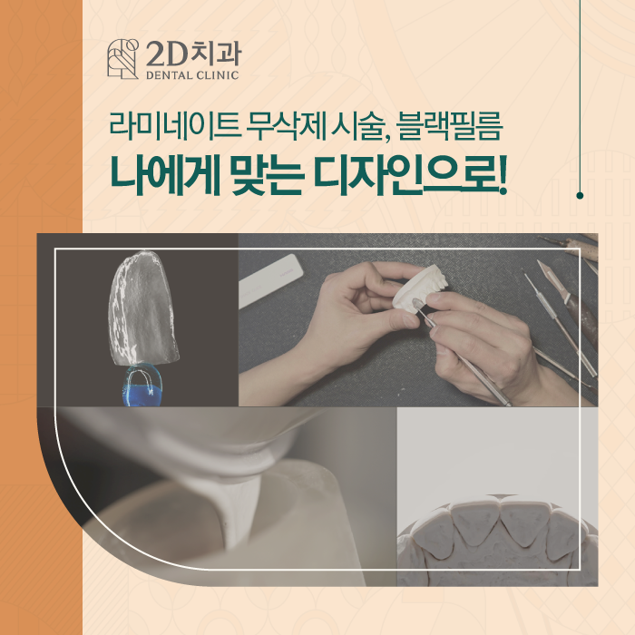 무삭제라미네이트비용 부담은 줄이면서 아름다운 치아로 관련 이미지 1