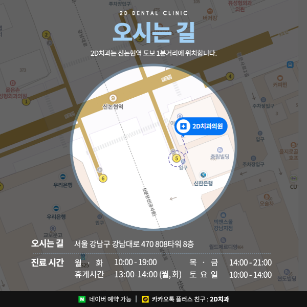 덧니가 두드러져 스트레스일 땐? 2D부분교정 관련 이미지 8