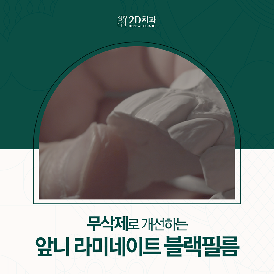 전주무삭제라미네이트 앞니 고민 개선은 블랙필름으로 관련 이미지 1