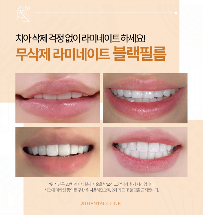 무삭제라미네이트후기 블랙필름 중요한 POINT 3 관련 이미지 7