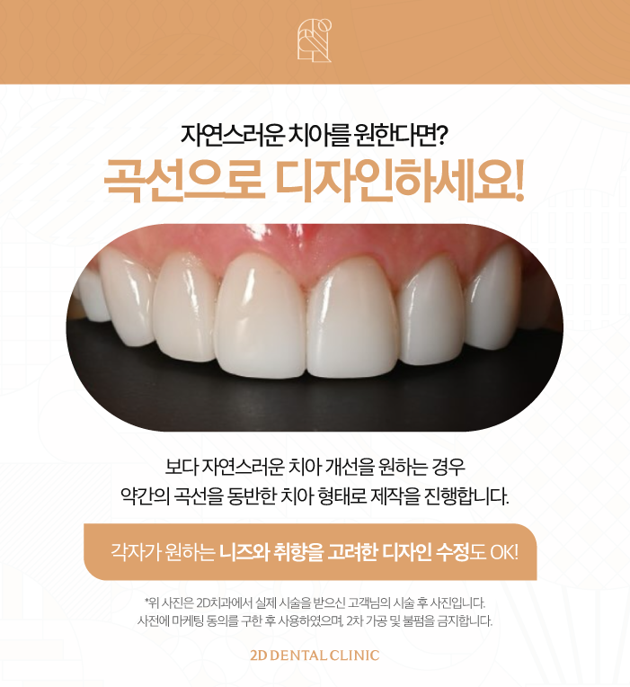 무삭제라미네이트비용 부담은 줄이면서 아름다운 치아로 관련 이미지 6