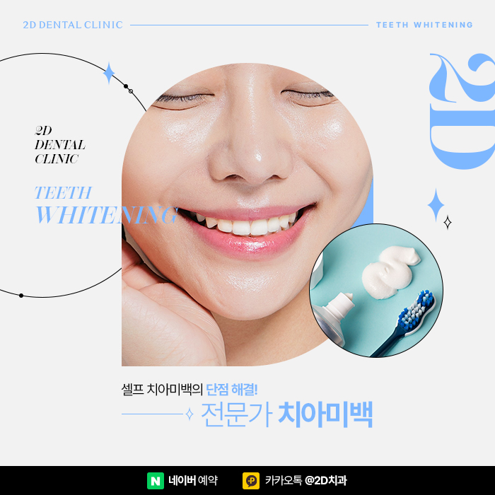 셀프치아미백의 단점, 전문가 치아미백으로 해결 위해서는 강남역 치과 관련 이미지 1