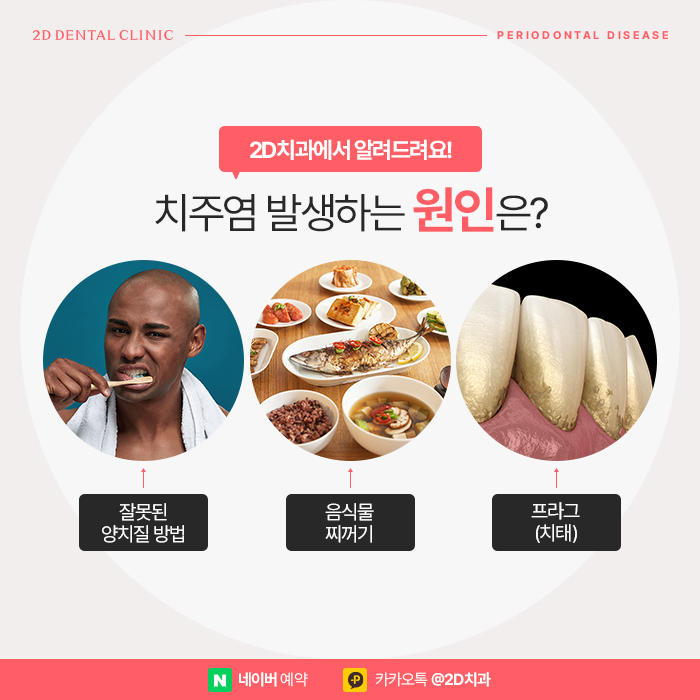 치주염증상은? 강남역 양심치과에서 알려드려요. 관련 이미지 3