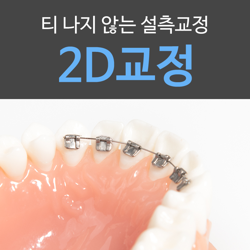 [투디(2D)치과] 2D치과의 2D교정이 특별한 이유! 관련 이미지 1