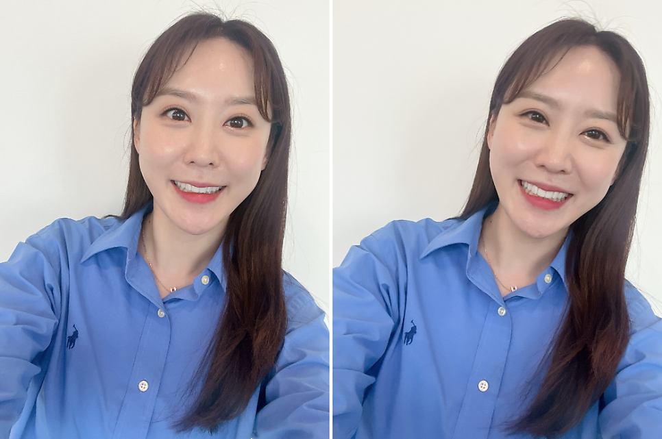 무삭제 라미미네이트 잘하는 투디치과 : 쇼호스트 이난주님의 블랙필름 후기 관련 이미지 1