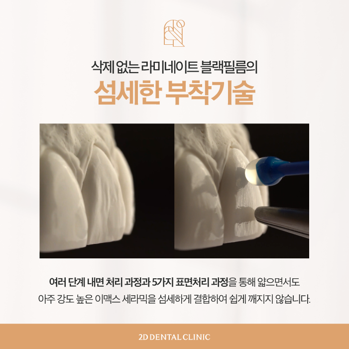 마취 필요 없는 블랙필름 무삭제라미네이트가격, 장점, 특징 관련 이미지 5