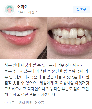 블랙필름 치아 가격 정확히 알고싶다면? 관련 이미지 10