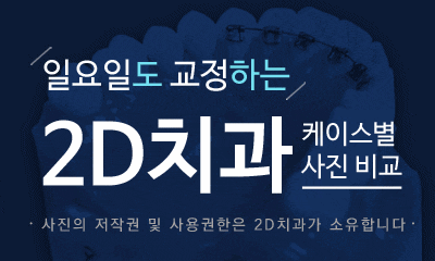 앞니 덧니 부분교정 케이스 전후비교, 교정전문 2D치과 관련 이미지 3