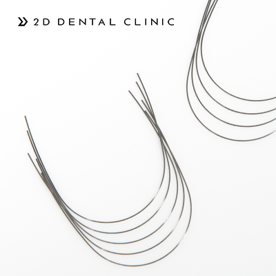 [투디(2D)치과] 교정 와이어의 종류 관련 이미지 2