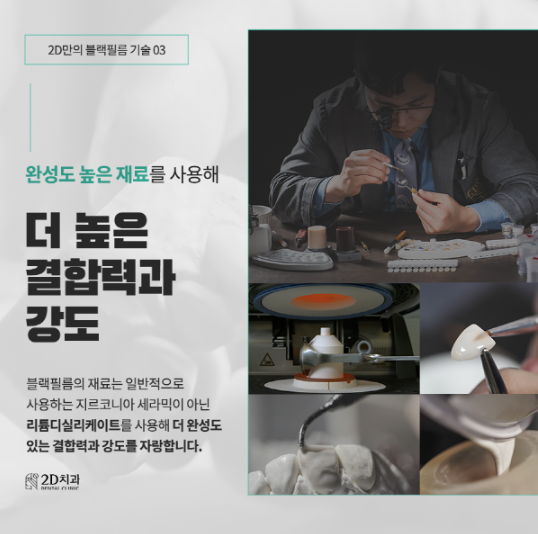 강남치과 블랙필름 무삭제라미네이트비용 관련 이미지 4