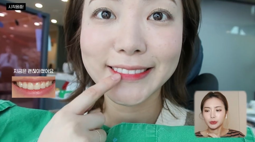 무삭제 라미네이트, 쎄라필름(TheraFilm)후기_유튜버Coco Riley님 by.2D치과(투디치과) 관련 이미지 12