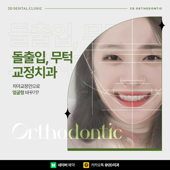 치아교정으로 얼굴형이 바뀔까? 돌출입, 무턱 교정치과 관련 이미지 1