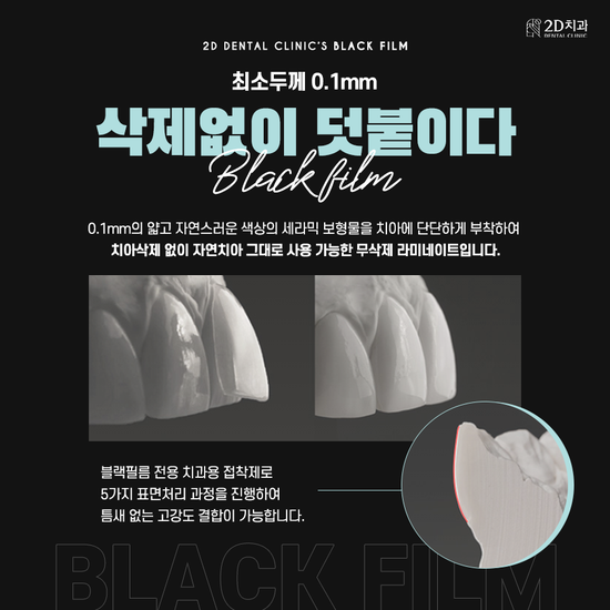 진짜 관련 이미지 4