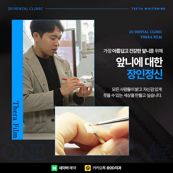 치아미백 가격, 비용 걱정 없이 진행하려면, 신논현 치아미백 치과 관련 이미지 3