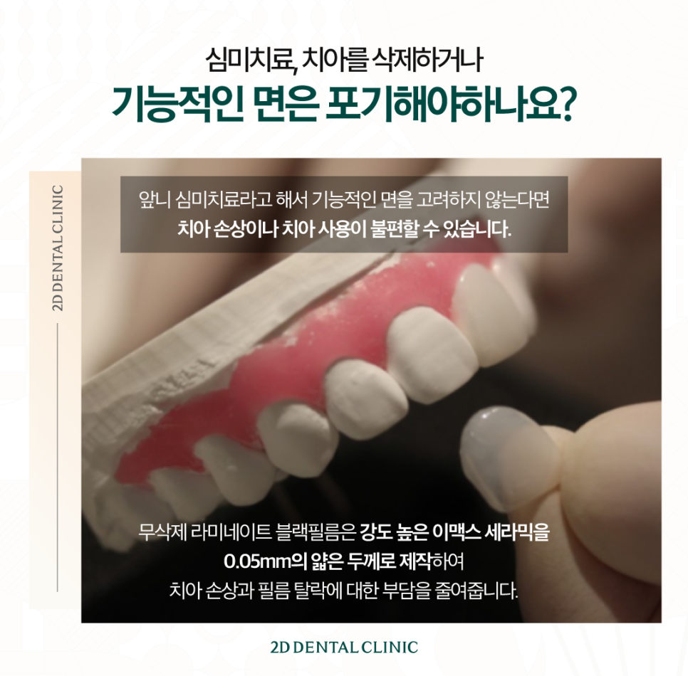 광주무삭제라미네이트 앞니심미치료 깔끔한 치아가 그저 부러웠다면 관련 이미지 4