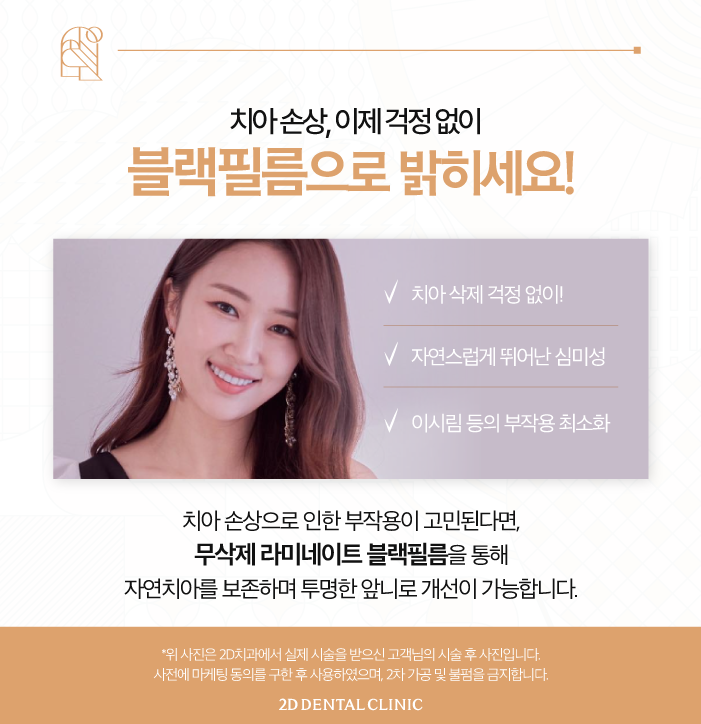 무삭제라미네이트가격 자신감 있게 활짝 웃는 방법 관련 이미지 5