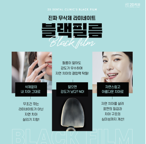 연예인라미네이트 블랙필름 무삭제라미네이트가격 관련 이미지 5