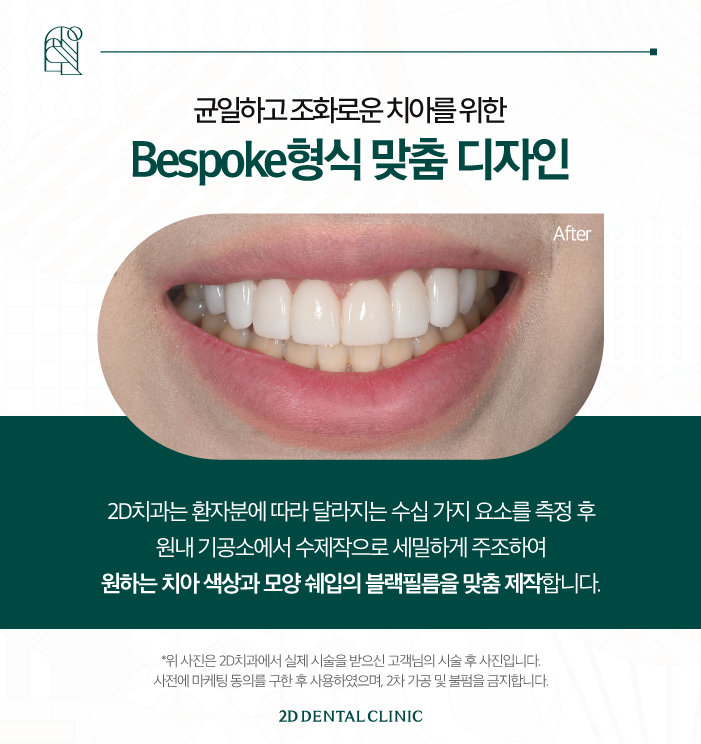 무삭제라미네이트가격 토끼 앞니도 개선이 되나요? 관련 이미지 5