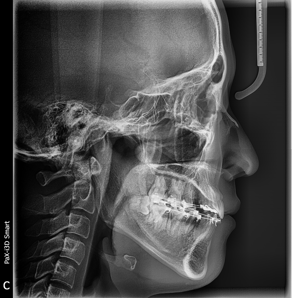 강남역치과 [투디치과] 최대리님 교정진행중/직원들도 믿고 교정해요! 관련 이미지 2