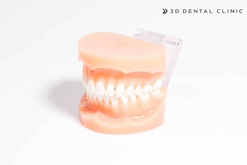 방학기간 동안 대학생을 위한 앞니 부분교정 종류 관련 이미지 9