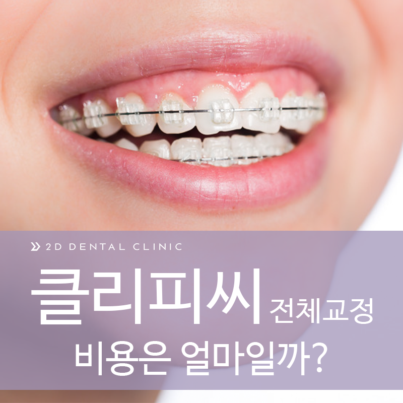 클리피씨 교정 가격 얼마일까? 강남 2D치과 관련 이미지 2