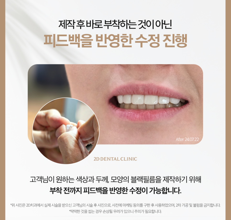 치아화이트닝 하얀이로 거듭날 수 있었던 투디 고객님의 고민은? 관련 이미지 5