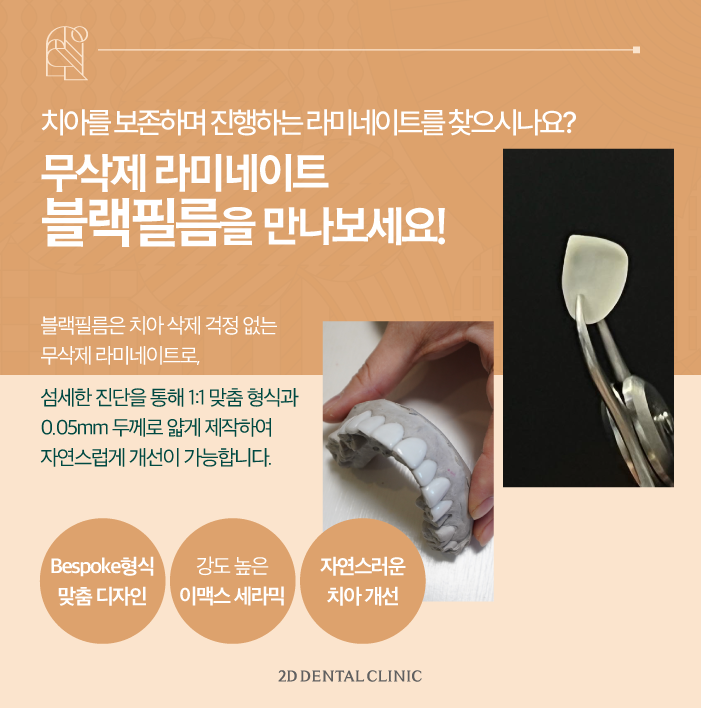 무삭제라미네이트비용 부담은 줄이면서 아름다운 치아로 관련 이미지 3