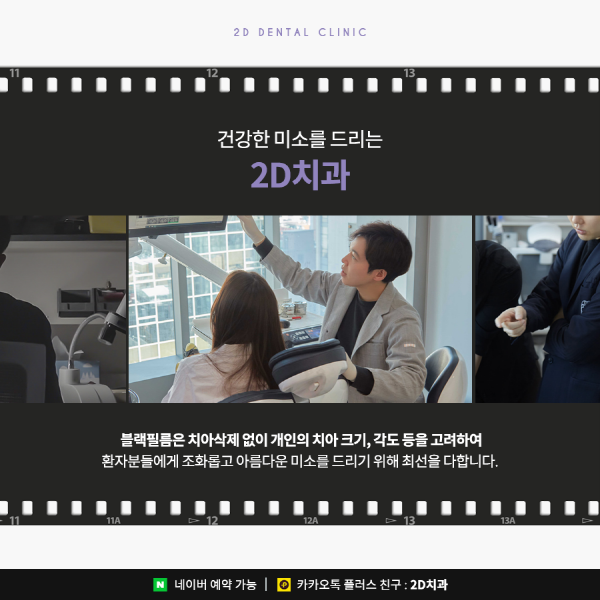 앞니 라미네이트 블랙필름의 효과성 A to Z 관련 이미지 7