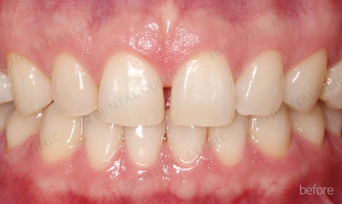 김현진 연애의맛? 또 어디서 봤더라? 관련 이미지 9