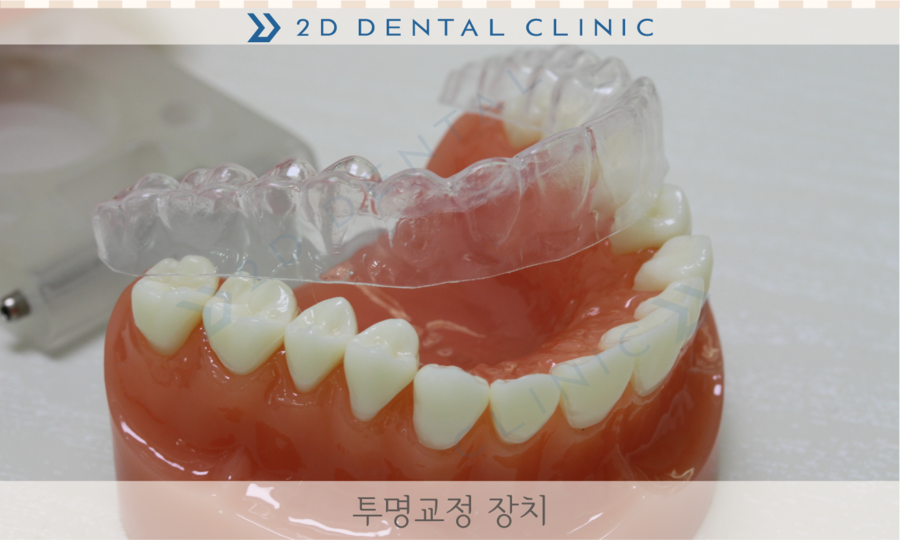 [교정상식] 설측교정,투명교정,콤비교정 장치종류 및 장단점! 관련 이미지 2