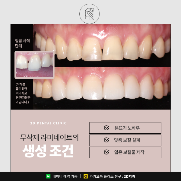 100% 무삭제 라미네이트 <블랙필름>이 가능한 이유는? 관련 이미지 2