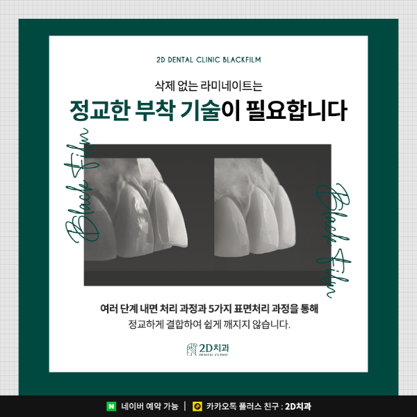 완전 무삭제 라미네이트 블랙필름, 장인의 손길로 탄생하다! 관련 이미지 5