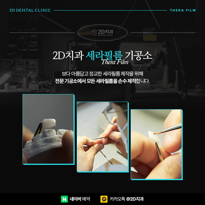 왜소치 세라필름, 원데이라미네이트로 해결하기 위해서는 강남역 치과 관련 이미지 5